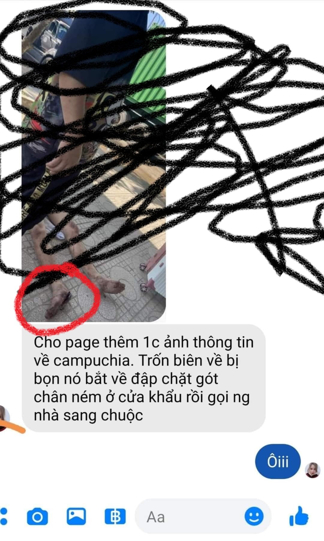 Bị chặt g&oacute;t ch&acirc;n v&igrave; d&aacute;m chạy trốn