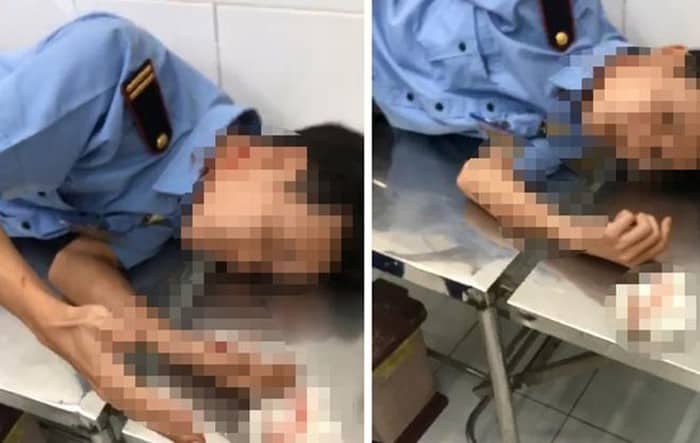 Bảo vệ K bị thằng mất dạy nẹt p&ocirc; ch&eacute;m phải nhập viện