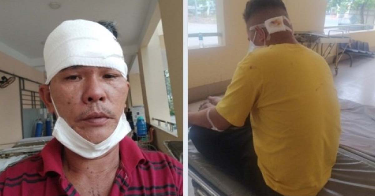 QUÁ MẤT DẠY: CÔNG TY BẢO VỆ ĐẬP NHÂN VIÊN 